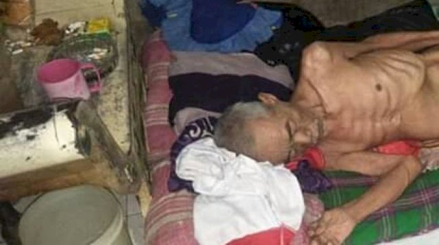 Icing, Kakek Miskin di Banten, Badan Tinggal Tulang Tak Dapat Bantuan Bansos Pemerintah