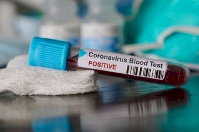 Hasil Rapid Testnya Positif, Satu Keluarga di Aurduri Sungaipenuh Hanya Isolasi Mandiri di Rumah