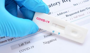 Catat, 20 Puskesmas di Muarojambi Ini Layani Rapid Test Gratis