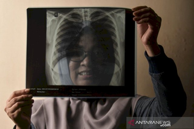 Berkurang 11 Orang, Jumat RSD Wisma Atlet Rawat 614 Pasien