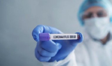 Rekor Baru! Kasus Positif COVID-19 pada 2 Juli Tambah 1.624