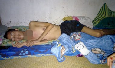 Hidup Sebatang Kara dan Idap Kanker Getah Bening, Pemuda di Sarolangun Ini Butuh Bantuan