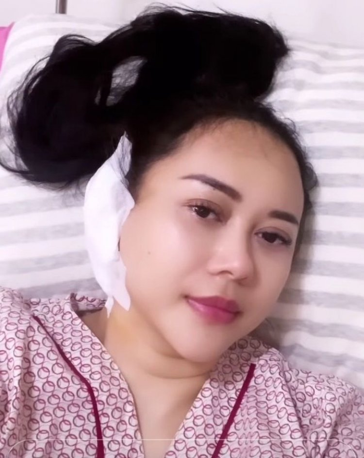 Gendang Telinga Bocor, Begini Kondisi Terkini Aura Kasih