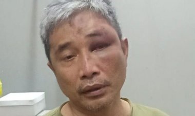 Polri Sebut Ini Dia Peran Ketua RT di Balik Bonyoknya Muka Muhammad Kece oleh Irjen Napoleon