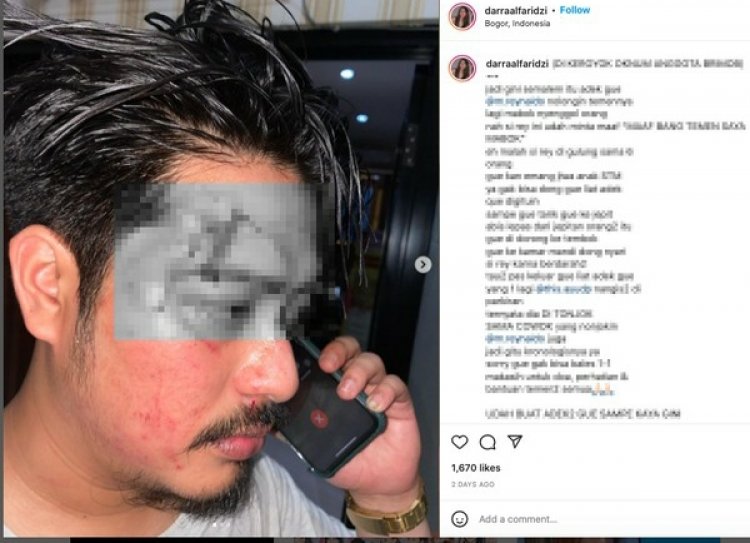Artis FTV Darra Permata Al Faridzi Ngaku Dikeroyok, Begini Kondisinya