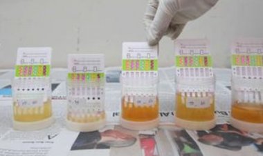 Ketar-ketir, BNN Tes Urine Sopir di Terminal Kampung Rambutan