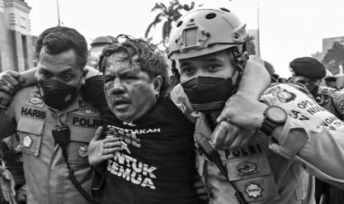 DUH! Ade Armando Ngaku Bonyok Dikeroyok Sasarannya Bagian Ini