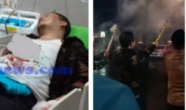 NAHAS! Saat Rayakan Malam Tahun Baru, Petasan Dipegang Wabup Kaur Meledak