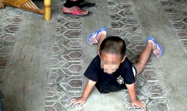 Heboh Anak Berkelamin Ganda, Orantua Bingung Status Gendernya