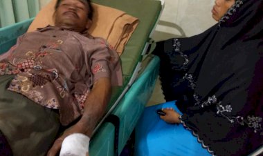 Padamkan Api Karhutla, Anggota Regu Pemadam Perusahan Pasrah Kehilangan Jari Kelingking