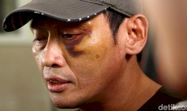 Polisi Sebut Munarman FPI Dalam Kasus Penganiayaan Ninoy Karundeng