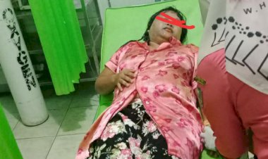 Janda Muda Ini Disiram Air Keras oleh Orang Tak Dikenal