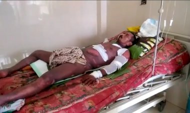 Warga Sengeti Ini Penderita Sindrom Steven Jhonson, Butuh Bantuan Dermawan