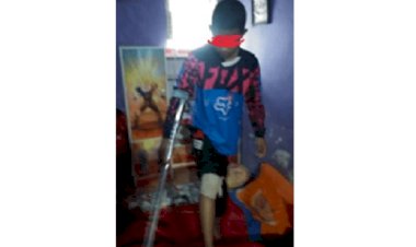 Tak Ikut Yasinan Oknum Guru Kerinci Diduga Tendang Siswa Hingga Tulang Kakinya Lepas