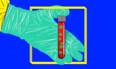 Alat Tes Virus Corona Tiba, PT RNI akan Jual ke Rumah Sakit