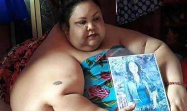 Kata Pakar, Begini Kronologi Obesitas Titi Wati