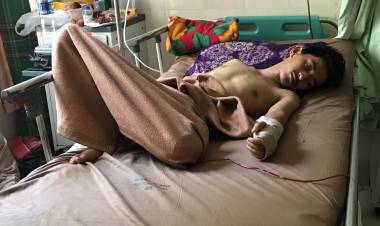 Diamputasi Akibat Kecelakaan, Siswa SMA di Tempino Butuh Uluran Tangan