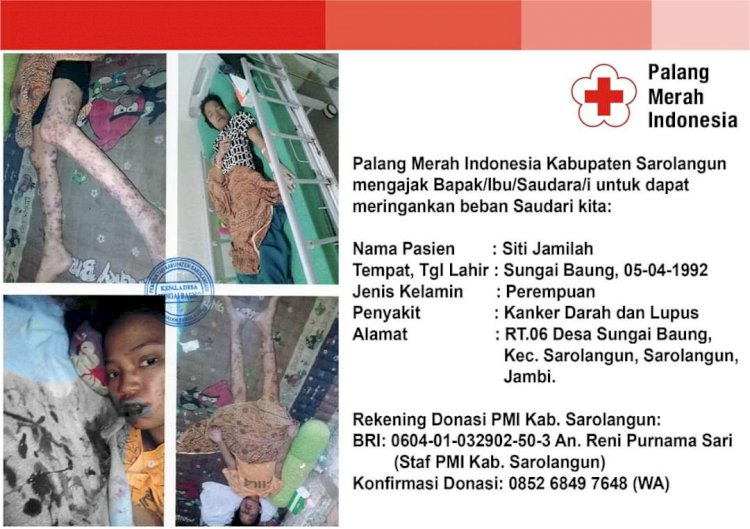 Derita Kanker Darah dan Lupus, Warga Sarolangun Ini Butuh Bantuan