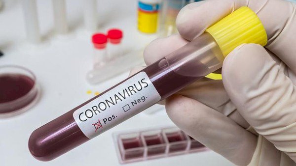 WNI Terkena Virus Corona COVID-19 di Singapura Sembuh